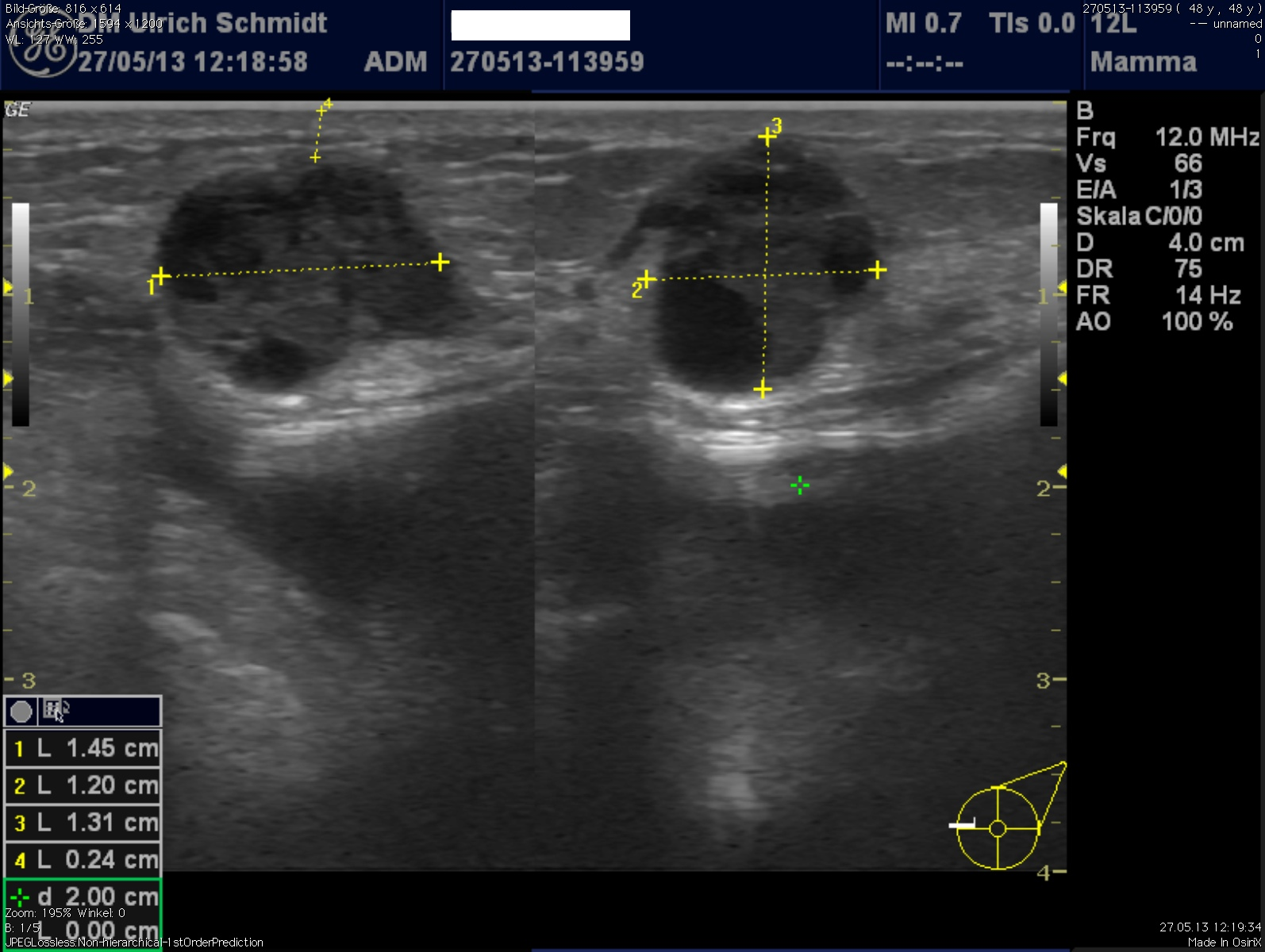 Mamma-Sonographie | Frauenarzt Gynäkologe Praxis Eberswalde Schorfheide ...